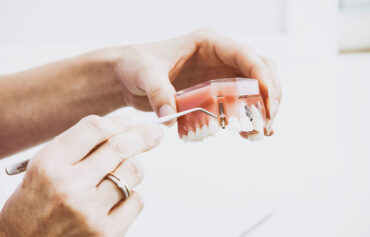 Terapia periodontal