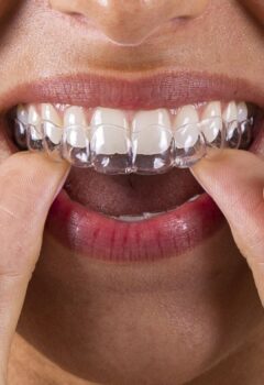 Ortodoncia invisible: alinea tu sonrisa de forma cómoda y discreta